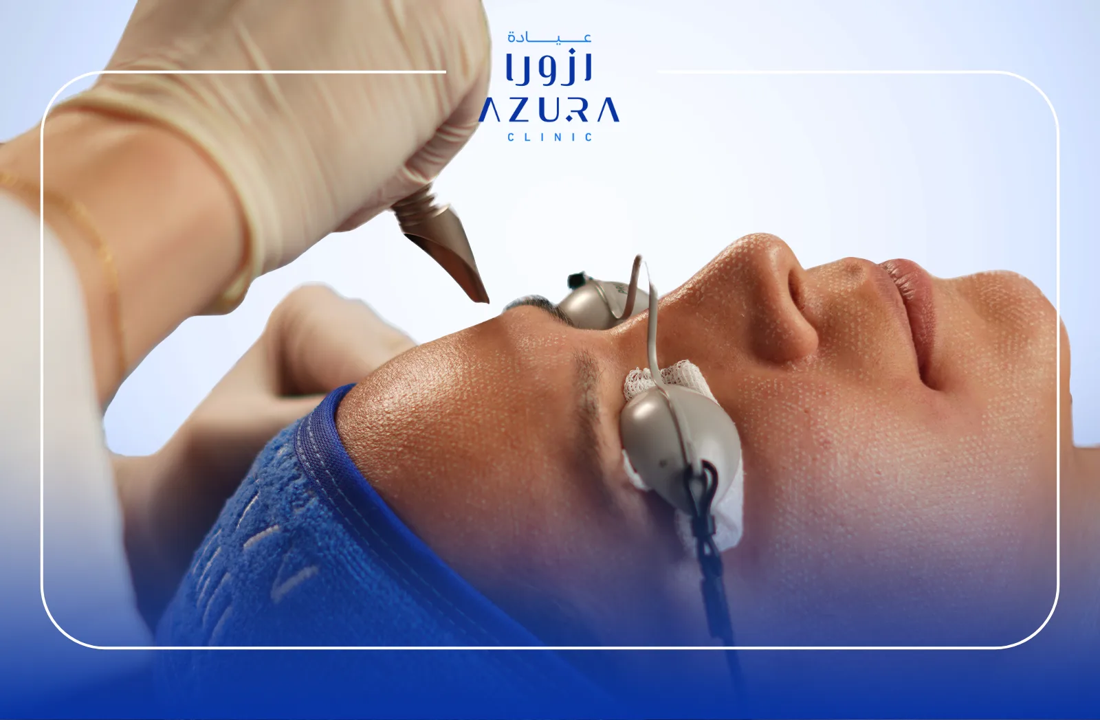 Fotona4D: 5 Key Benefits of the Remarkable Non-Surgical Facelift