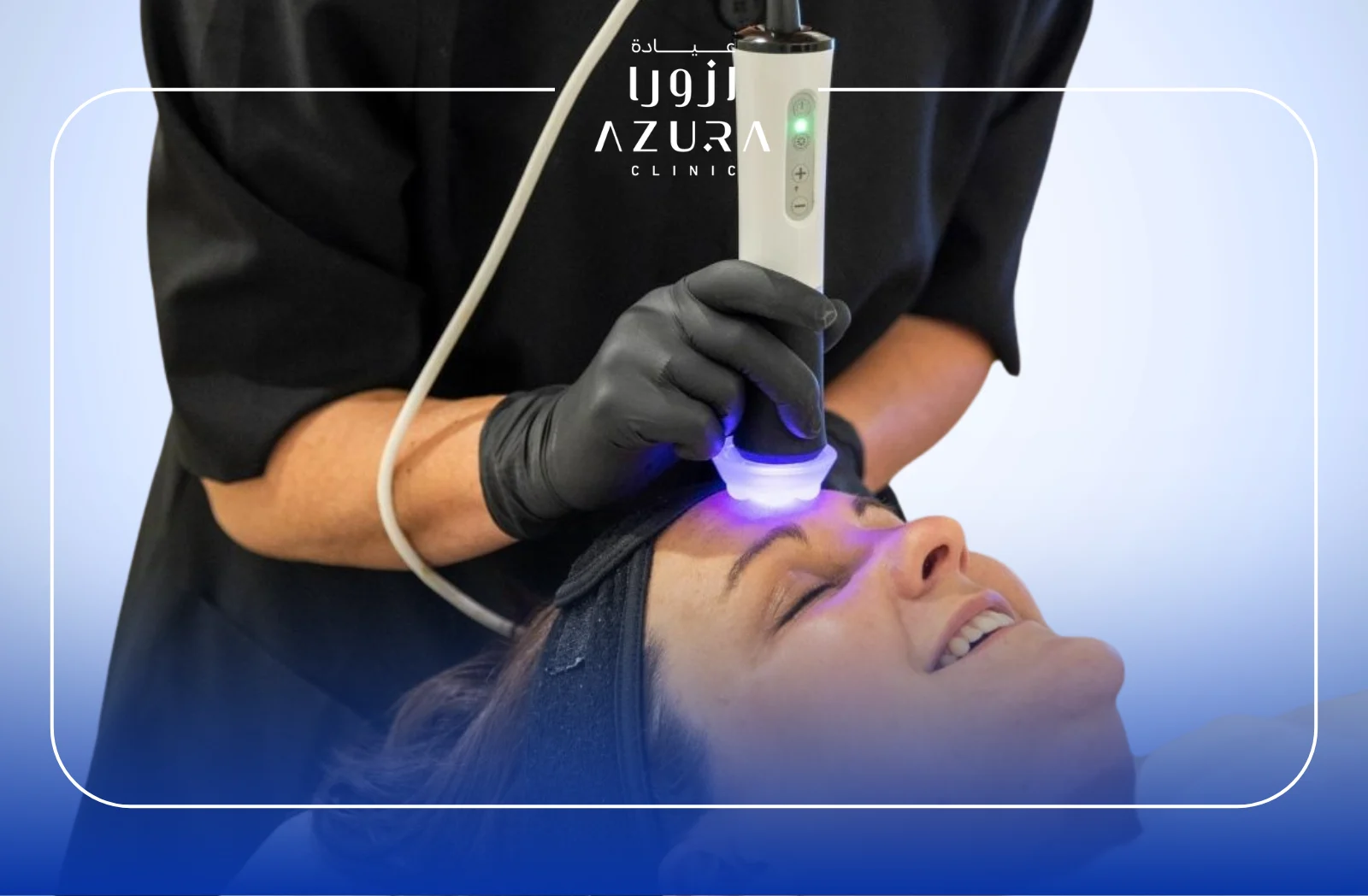 Pollogen Therapy: 7 Powerful Benefits of This Non-Invasive Skin Rejuvenation Treatment