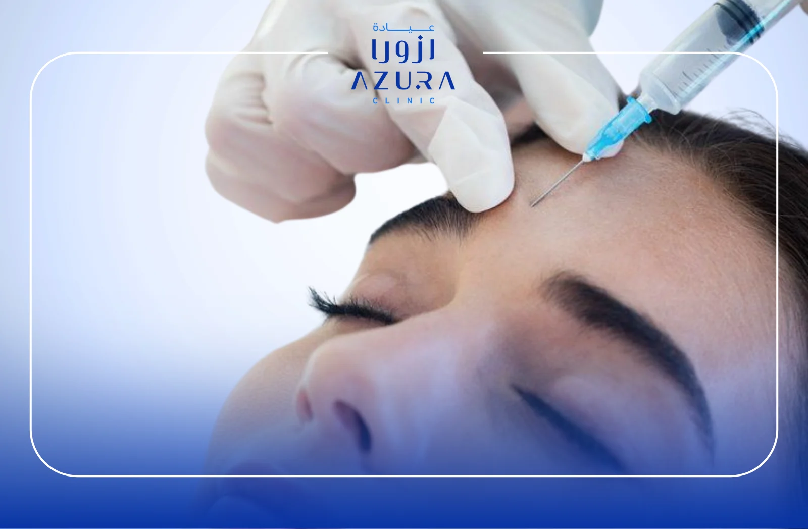 Botox for Migraine at Azura Clinic: 7 Powerful Benefits You’ll Love