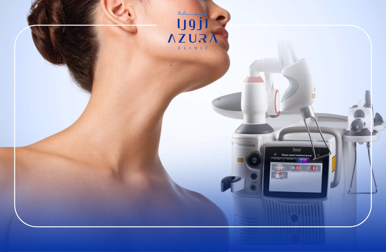 Double Chin Treatment with Fotona: 3 Key Benefits vs Meso & Combination at Azura Clinic