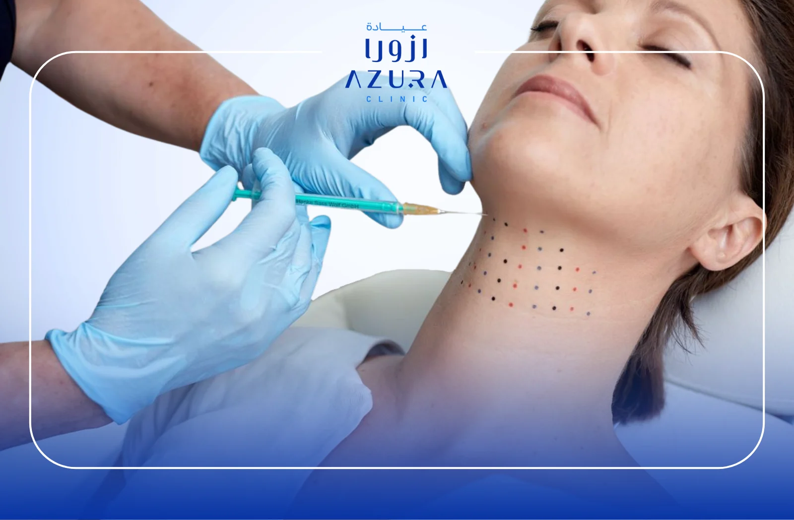Double Chin Treatment with Meso: 3 Key Advantages of Choosing Meso Over Fotona & Combo at Azura Clinic