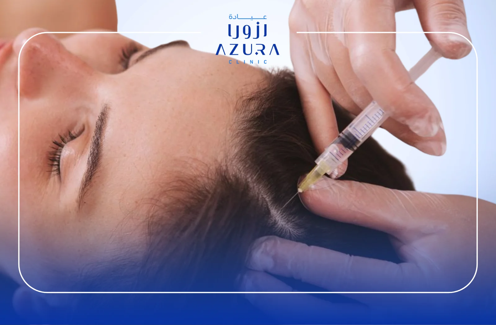 Exosome + Stem Cell Therapy for Hair: Top 7 Powerful Benefits You Need to Know