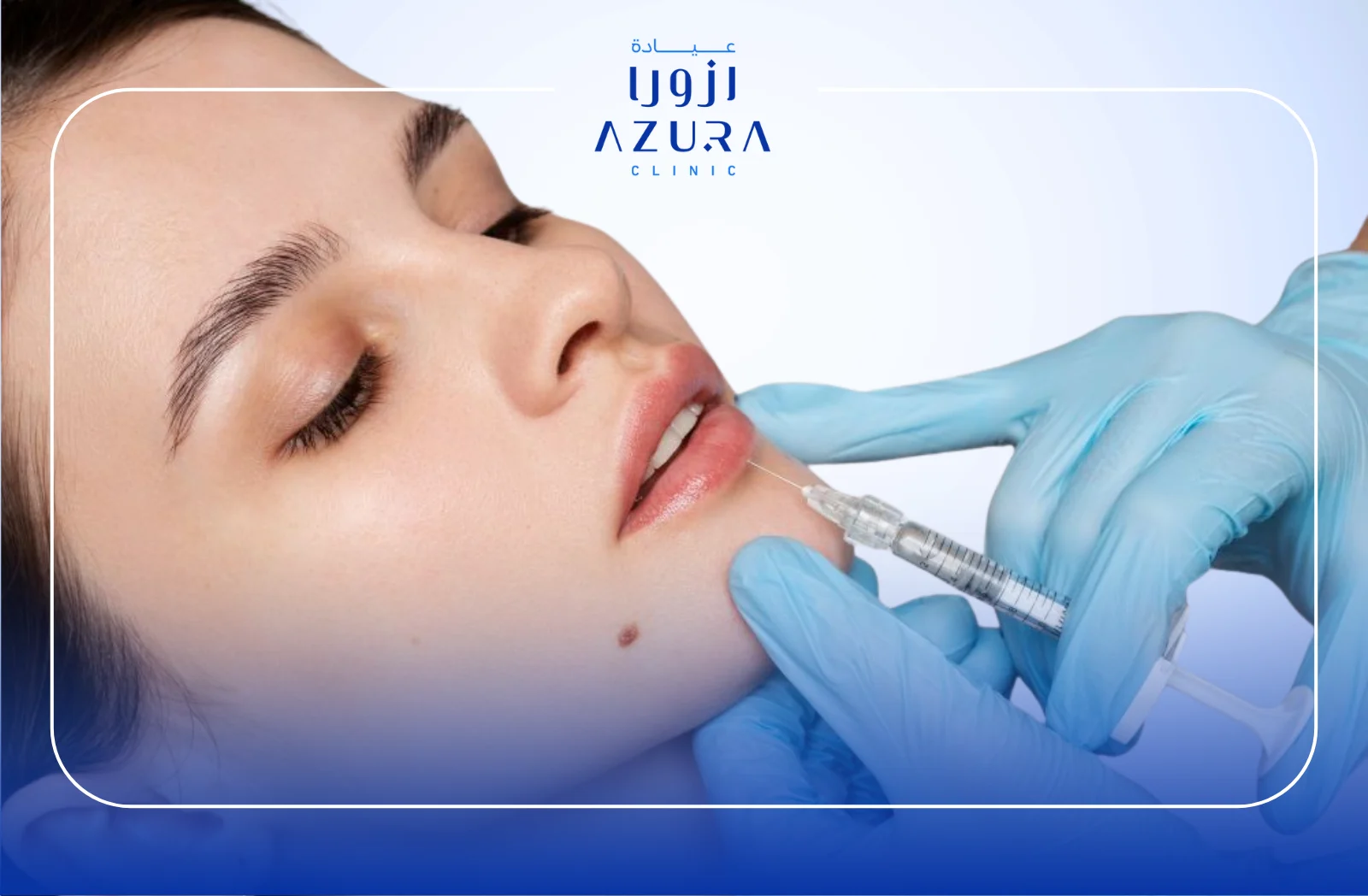 Lip Filler Treatments at Azura Clinic: 5 Amazing Benefits & Brand Differences