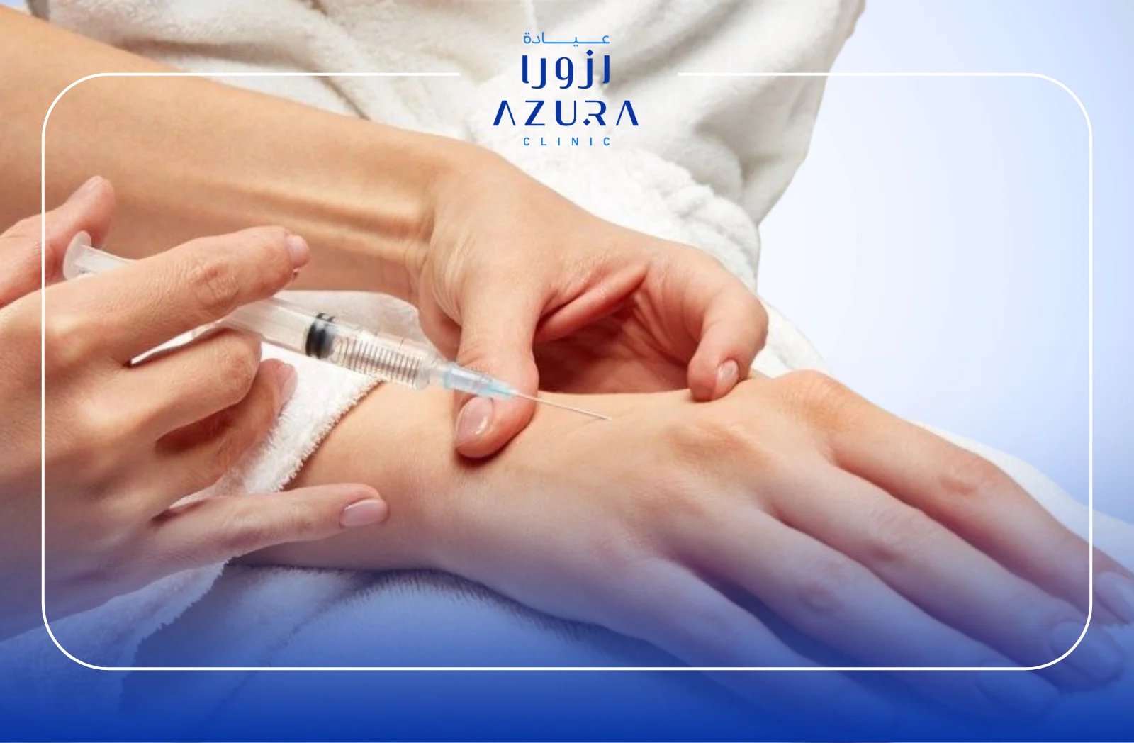 1-Session Hand Filler Treatments with Restylane, Juvederm & Amalian: Restore Youthful Hands Instantly