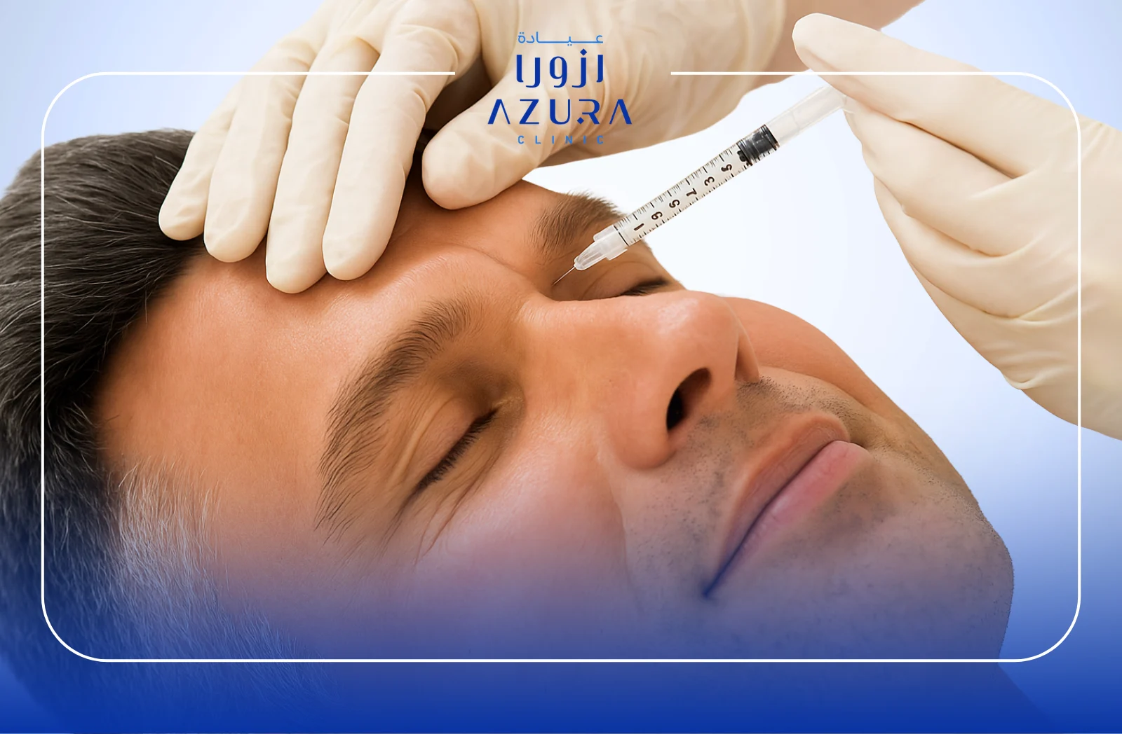 10 Amazing Benefits of Profhilo Skin Booster for Radiant, Youthful Skin