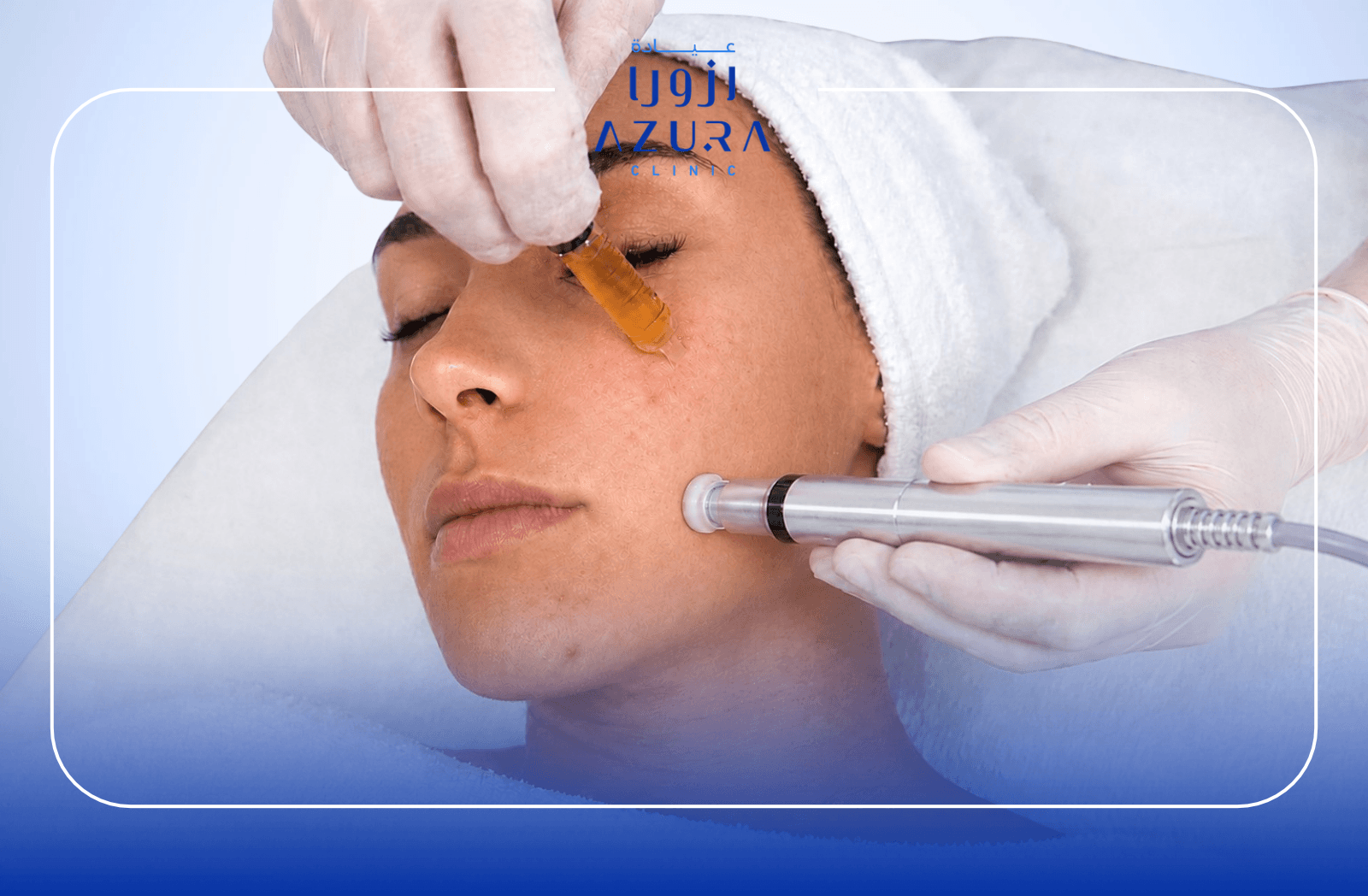 Advanced microneedling with mesotherapy facial treatment at Azura Clinic
