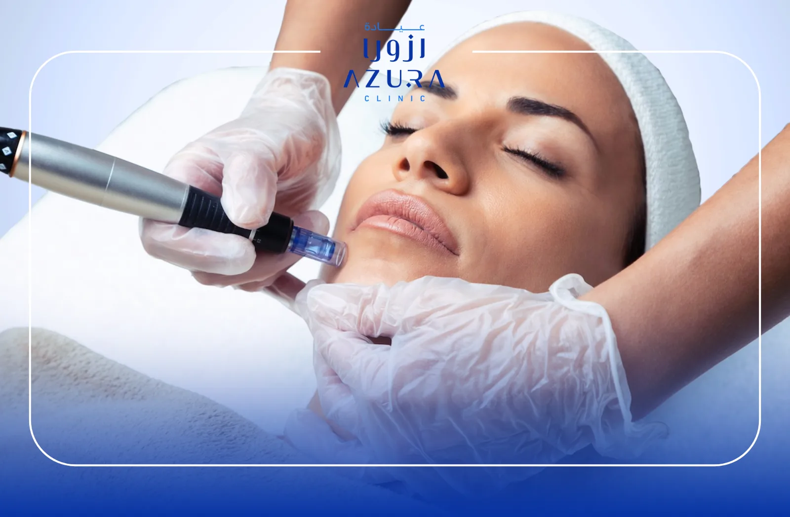 Advanced Microneedling+ Mesotherapy