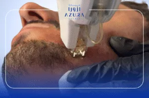 Biotin & PRP for Beard