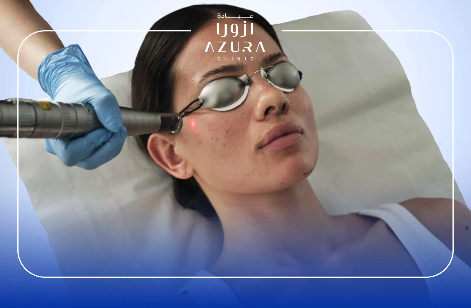 Face Glowing with Q-Switched Laser