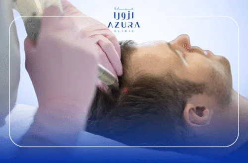 Fotona Hair restart and PRP