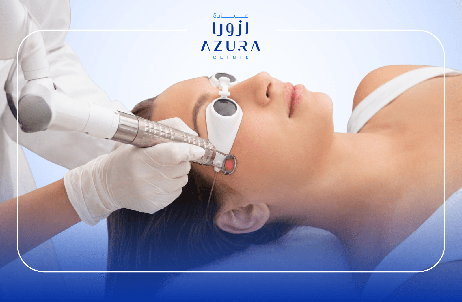 Fotona laser peeling treatment for glowing skin at Azura Clinic Muscat