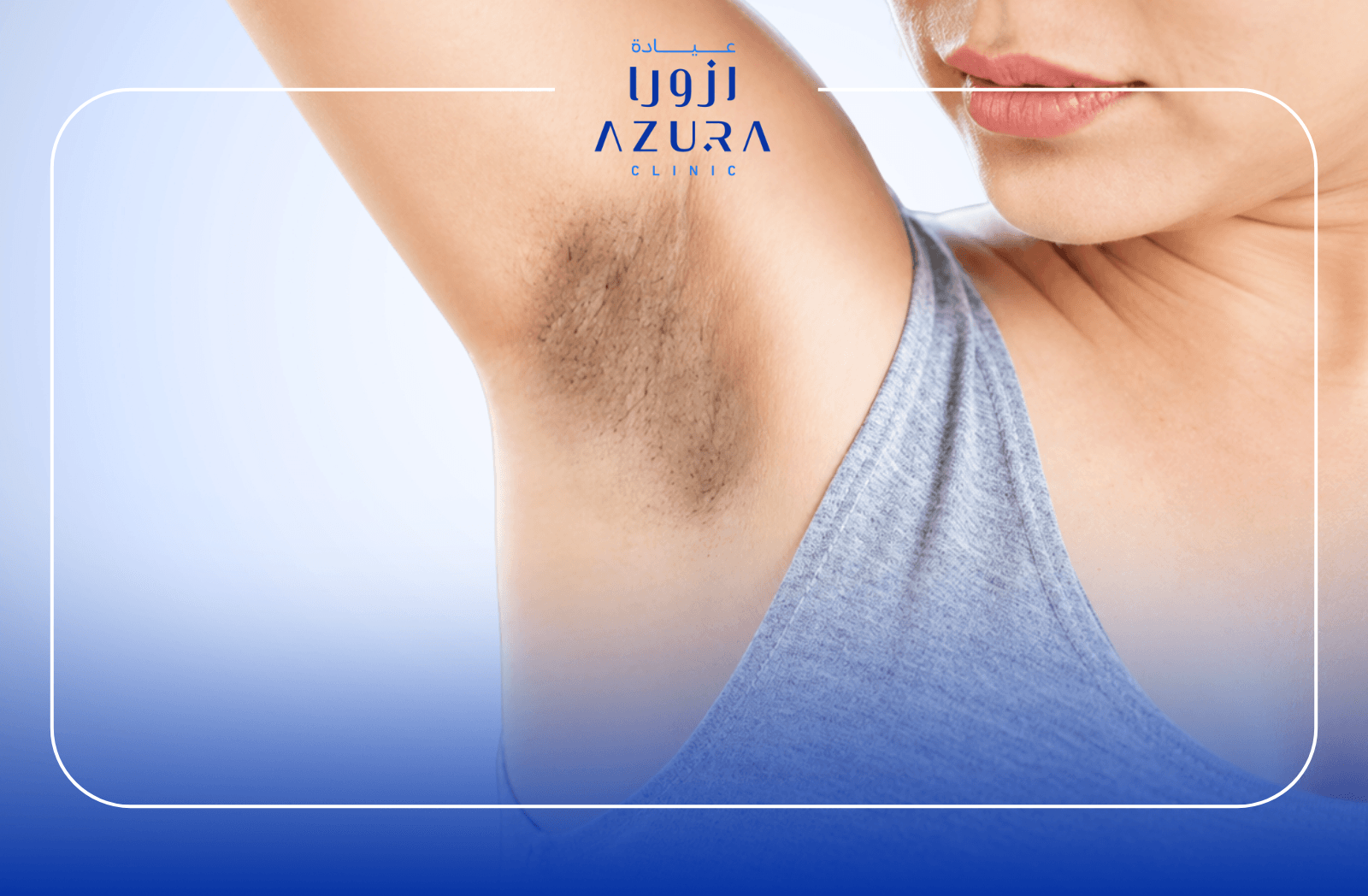 Fotona laser underarms whitening treatment at Azura Clinic Muscat
