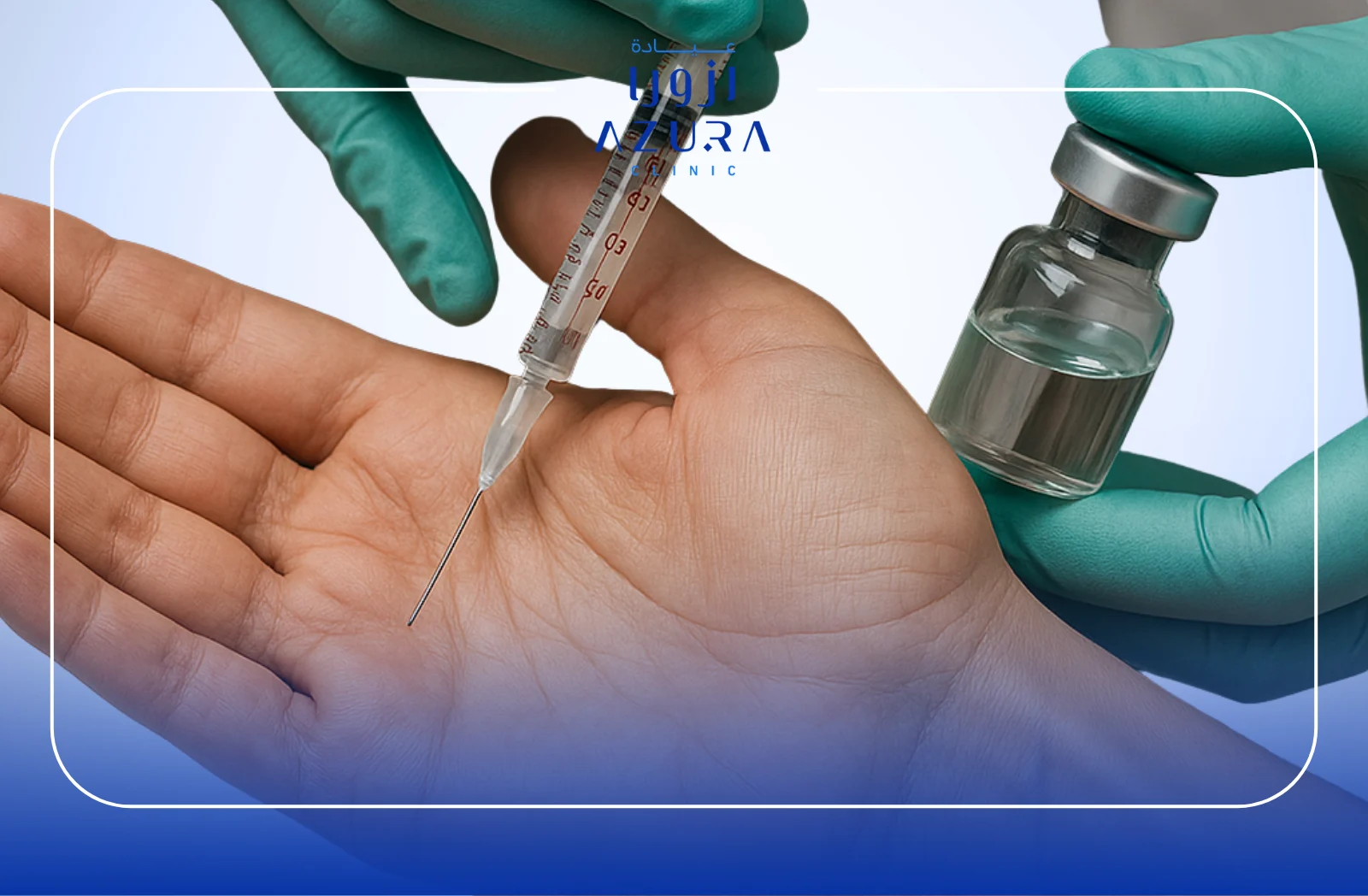 Hand Sweating Botox: 7 Powerful Reasons to Say Goodbye to Sweaty Palms