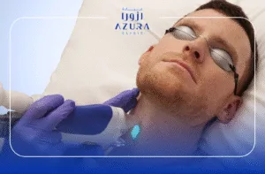 Laser Hair Removal for Men