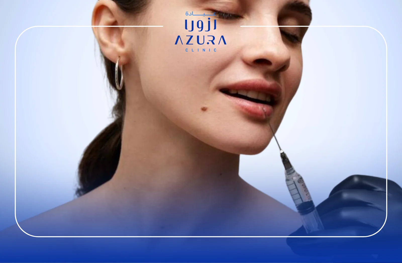 Lips Glowing with Mesotherapy: 7 Benefits You Need to Know