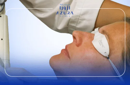 Neck Rejuvenation