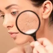 scar reduction with prp