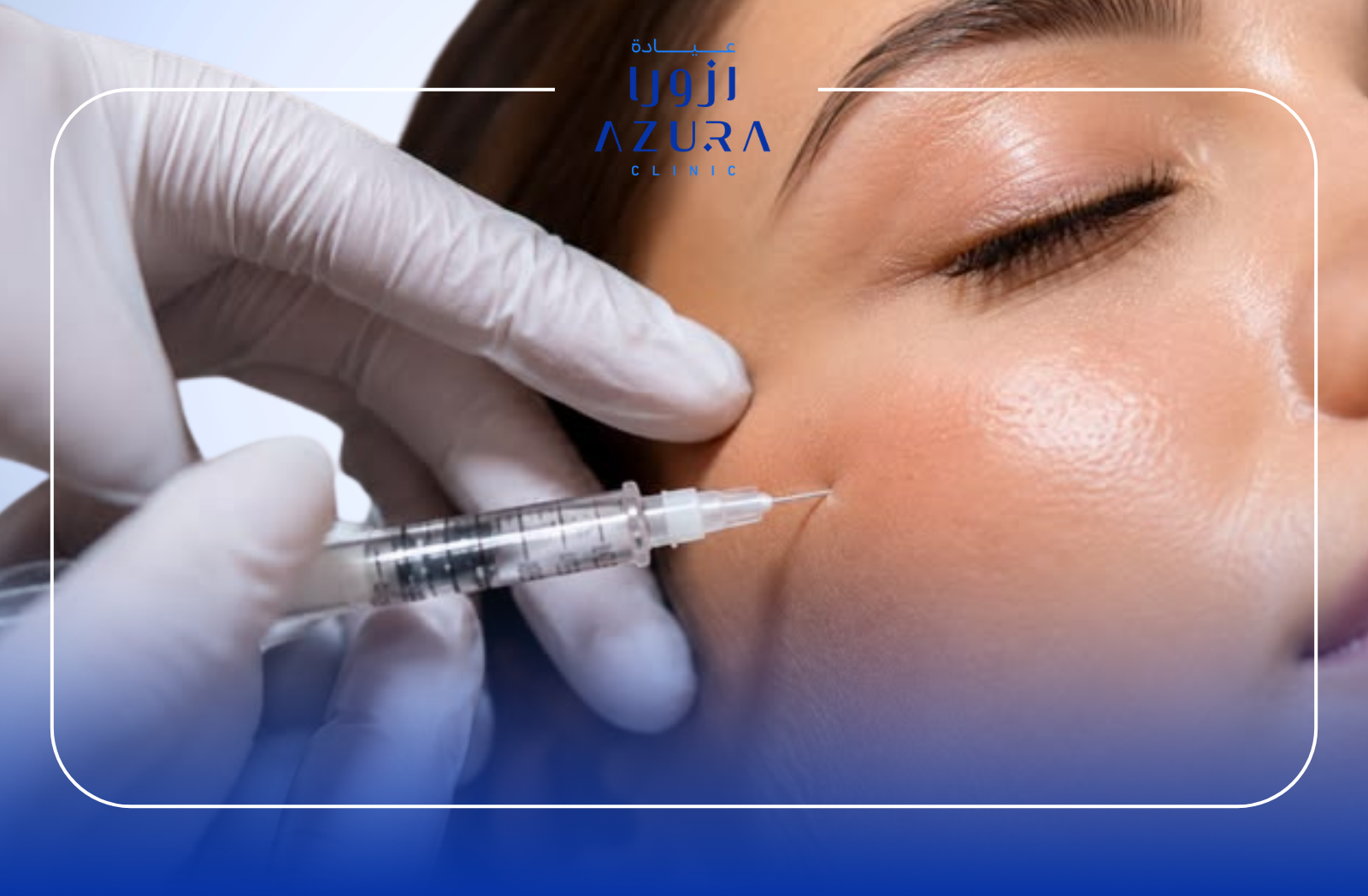 PRF injection for facial skin rejuvenation treatment at Azura Clinic
