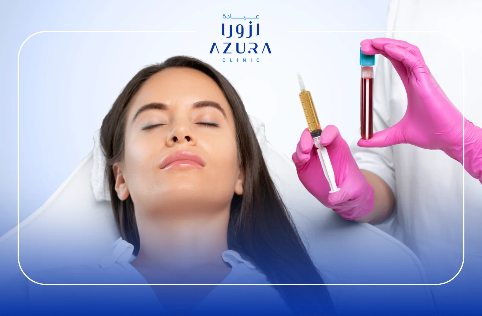 Scar Reduction with PRP: 5 Powerful Reasons to Try This Natural Skin Solution in 2025