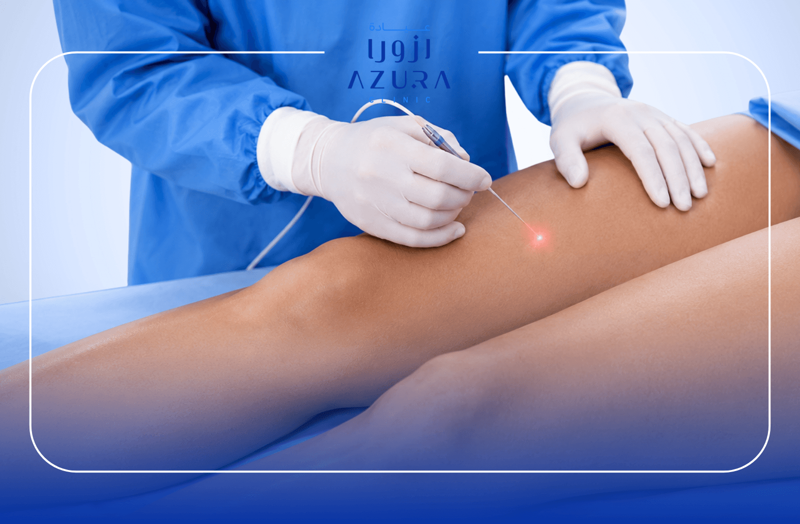 Thigh skin tightening treatment at Azura Clinic, showing a cosmetic laser procedure performed on the thigh area to support firmer and smoother-looking skin.