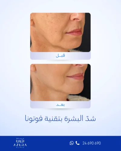 صورة المعرض