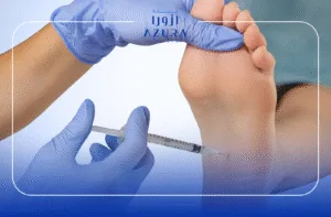 Foot Sweating 2 Foot Sweating