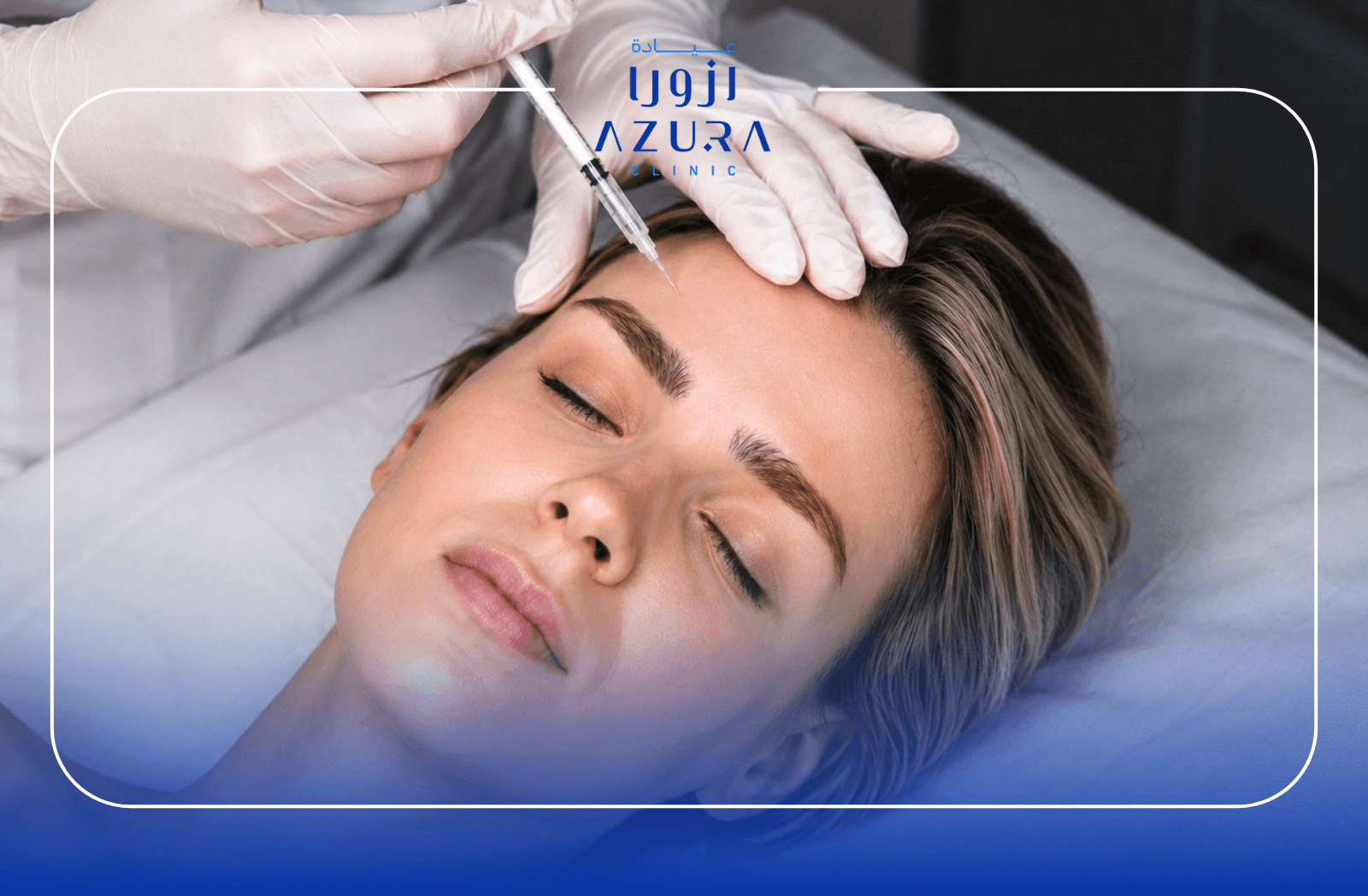 Full face Botox treatment at Azura Clinic Muscat targeting fine lines and expression wrinkles