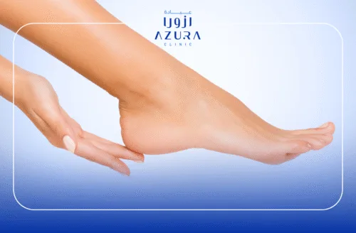 Microdermabrasion for Ankles