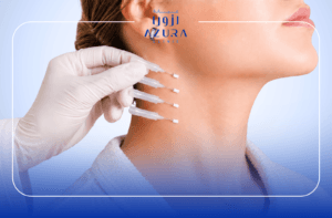 Neck Thread Lift