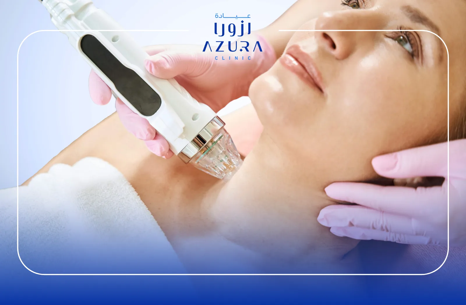 RF Fractional for Neck and Décolleté