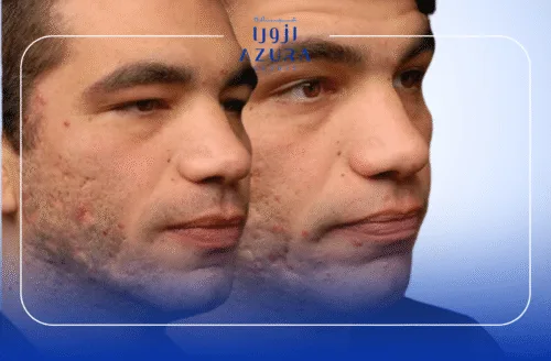 RF Fractional for Scarring