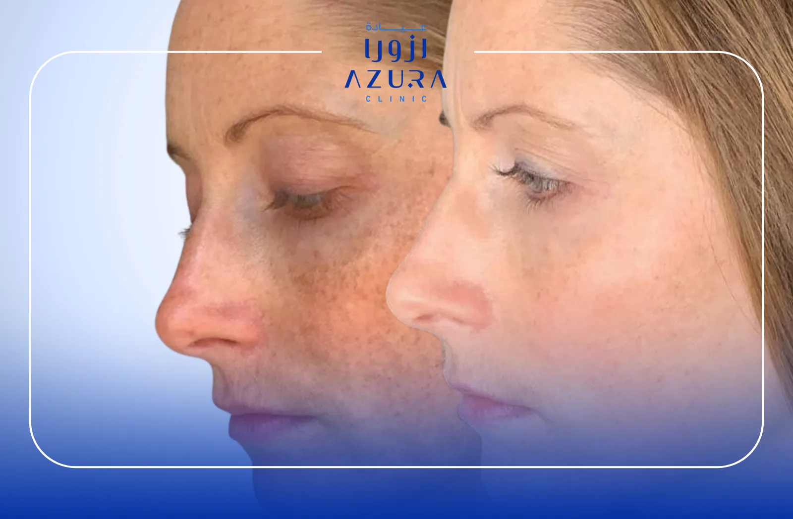 Face Glowing (Brightening)