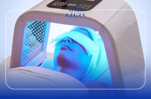 LED Therapy Facial