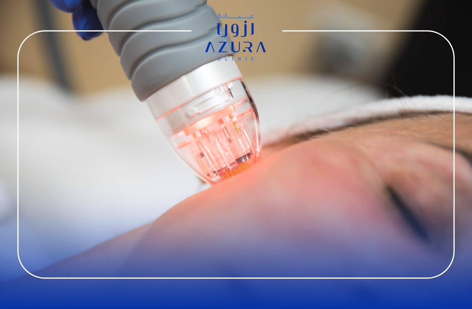 Vivace +Vitamin +PRP