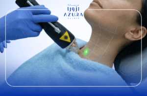 Laser Hair Removal for Women