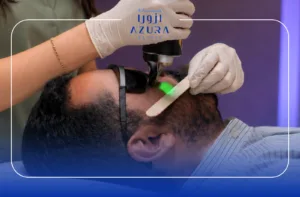 Laser Hair Removal for Men