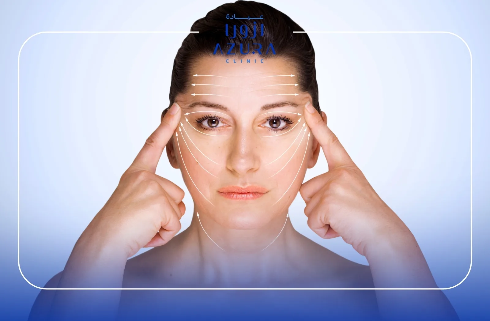 Lifting & Collagen Stimulation