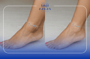Rub Off for Ankle
