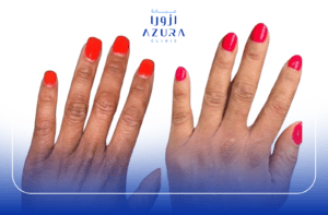 Rub Off for Hand
