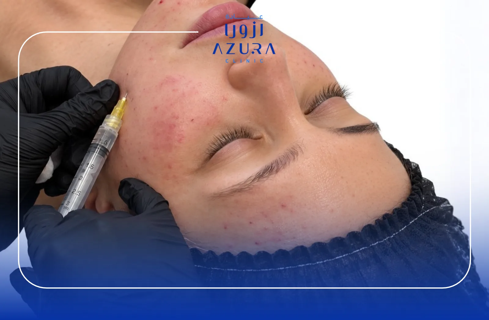 Azura Premium Full Face Brightening treatment at Azura Clinic Muscat