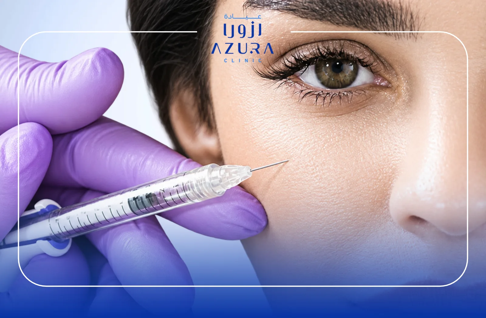 Yaqoot Premium Under-Eye Brightening at Azura Clinic Muscat to help improve the appearance of dark circles, dullness, and uneven under-eye tone.