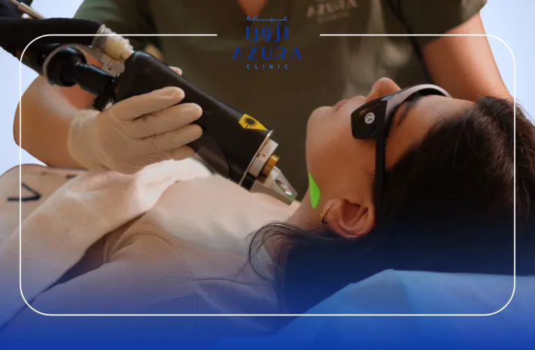 Face laser hair removal treatment at Azura Clinic Muscat using Splendor X