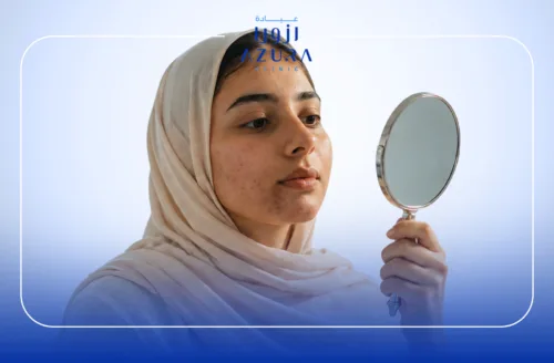 Dermatologist examining acne on a patient’s cheek during an acne treatment consultation in Muscat